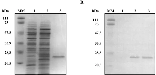 Figure n° 15: Analyse de l’expression du clone pQE-30 [Orchestine] par SDS-PAGE 12%.