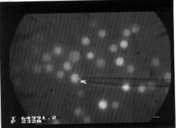 Figure  1.  Cell  aspiration  into  a  micropipette. 