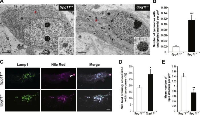 Fig. 10. Spatacsin loss promotes lipid accumulation in lysosomes in primary cultures of cortical neurons