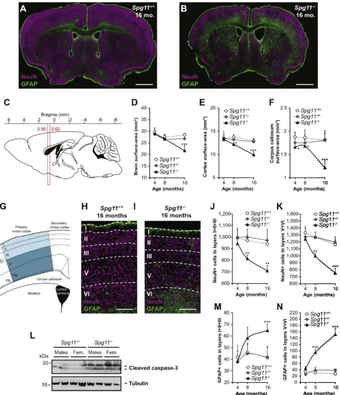 Fig. 3.Loss of spatacsin causes severe cortical damage. (A and B) Brain coronal slices of Spg11 +/+ (A) and Spg11 −/− (B) mice at 16 months of age