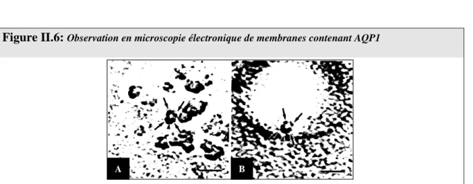 Figure  II.6:  Observation en microscopie électronique de membranes contenant AQP1