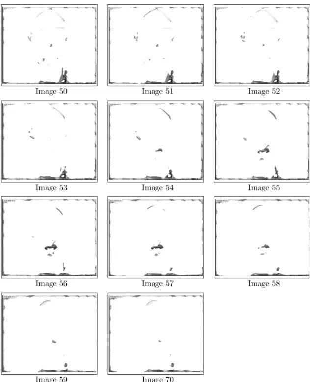 Fig. 3.19 – Illustration des r´ esultats du clustering 3D sur le cluster rejet sur la s´ equence Foreman