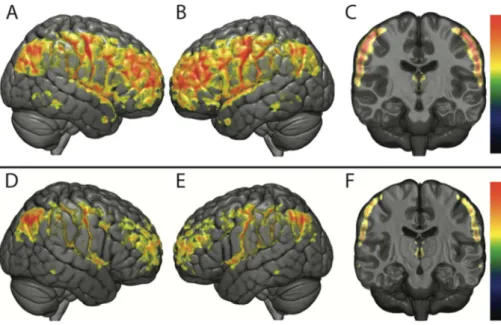 Fig. 2. Functional connectivity analysis using VMHC.