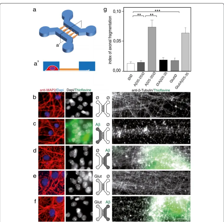 Figure 1 Somatic applications of A β peptides induce a dying-back pattern. a. Schematic representation of a two-chamber microfluidic device (2-C μ FD) with two cell culture chambers interconnected by funnel-shaped micro-channels [8] (a ’ : cross-section of