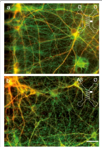 Figure 4 Exposure of cortical somata to A β -peptide induces an axonal loss in a reconstructed cortical-hippocampal network.