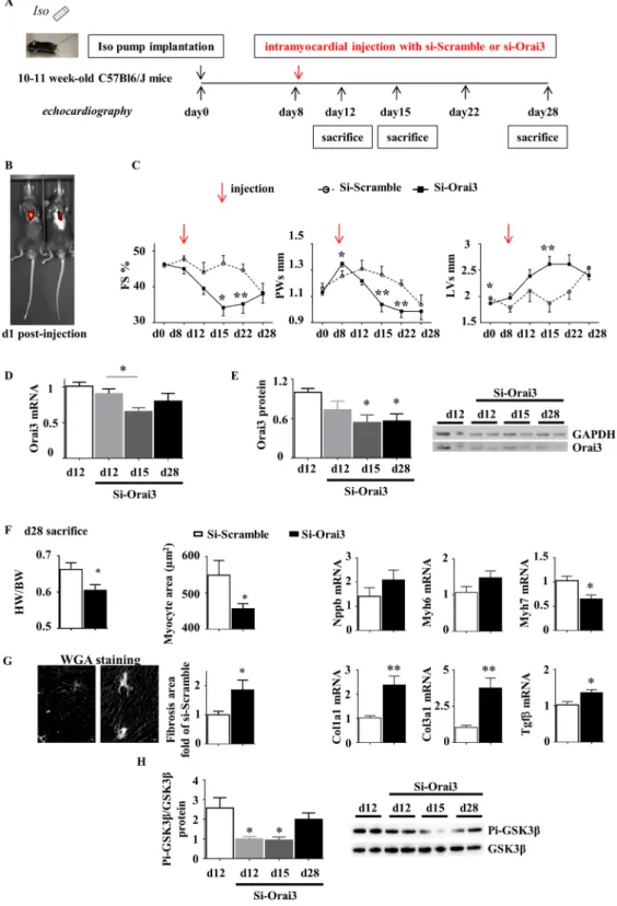 Figure 8.  Orai3 knockdown at the onset of EACH limits cardiac hypertrophy, accelerates alteration of function  and dilation and promotes fibrosis