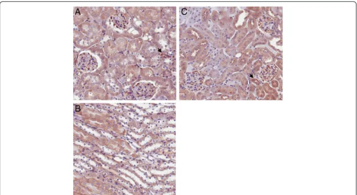Figure 3 Representative photomicrographs of kidneys from Pax8-rtTA/LC1/floxed ETA (iETA) mice before and after doxycycline (DOX) treatment