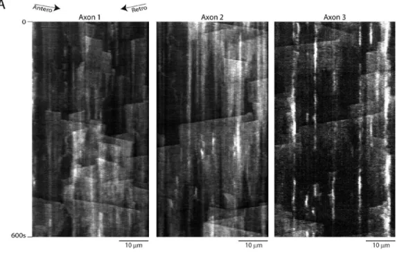 Figure S2.  Kymographs from F-actin imaging in axons with two independent probes. (A) Kymographs from three independent axons demonstrate consistent  GFP:Utr-CH dynamics, across transfected axons