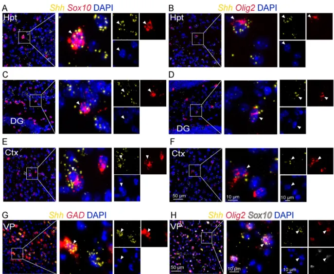 Fig 4. Shh mRNA expression in oligodendroglial cells. Multiplex in situ hybridization for Shh and for the oligodendroglial markers Olig2 and Sox10 as indicated, at the level of the tuberal region of the hypothalamus (Hpt) (A-B), the CA3 region of the hippo