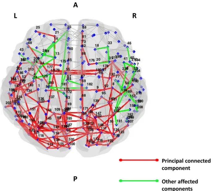 Fig. 3. A ﬀ ected functional connections in PCA patients relative to healthy controls (Network Based Statistic)