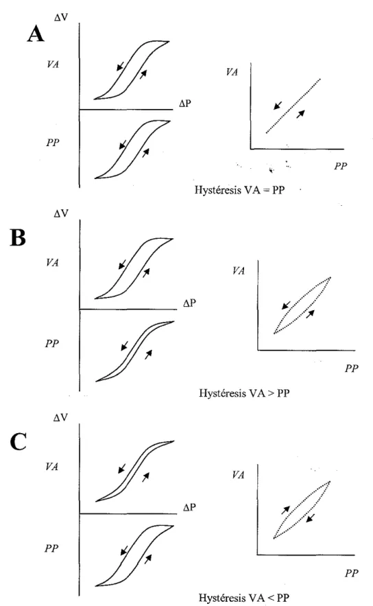 Figure 3: Illustration schématique des modifications relatives entre le volume des voies aériennes (VA) et le volume du parenchyme pulmonaire (PP)