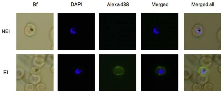 Figure 1 Evaluation of human serological response against RBC infected by RP8 P. falciparum strain by liquid indirect immunofluorescence assay (L-IFA)