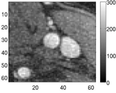 Figure 55: Example of a magnitude image obtained by PC MRI. The raw image is filtered after having chosen a region of interest.