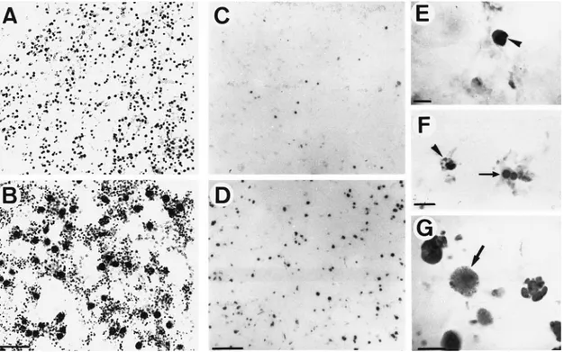 Figure 5. Number of TUNEL-positive cells in coronal sections at the level of the anterior commissure after ischemia and various reperfusion times in rat pups (n 5 4)