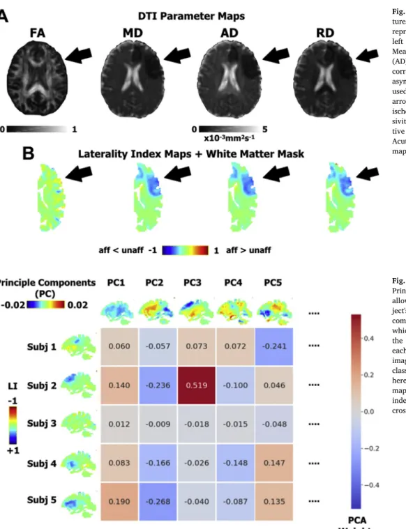 Fig. 2. Dimensionality reduction with Principle Component Analysis (PCA). PCA allows for the reconstruction of each  sub-ject's (subj) imaging data through a linear combination of principle components (PC), which reflect representative patterns over the st
