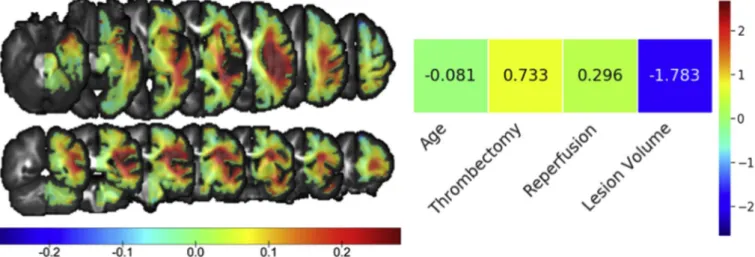 Fig. 5. Tractography analysis from the most influential regions for functional outcome.
