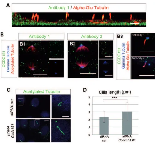 Figure 7. CCDC151 has a non-motile cilia function in IMCD3 cells. (A) CCDC151 is present in primary cilia of serum-starved IMCD3 cells ﬁxed in paraformaldehyde solution and stained with two different anti-CCDC151 antibodies (only Antibody 1 is shown)