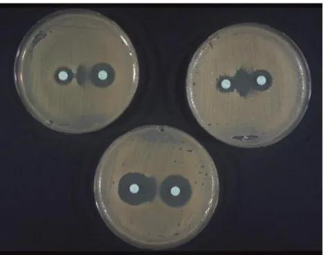 Figure 6: Trois tests de synérgie positifs chez 3 souches bactériennes différentes  (Image en « bouchon de Champagne »)
