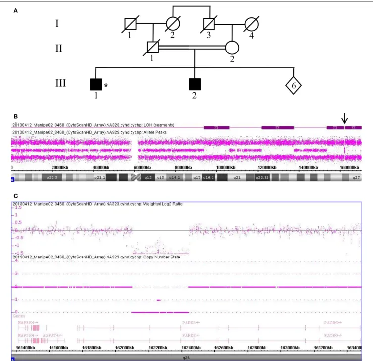 FigUre 3 | Chromosomal microarray analysis showing a homozygous deletion in PRKN in Patient 3468