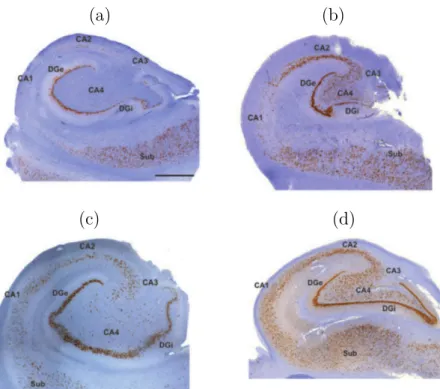 Figure 2.7 – Histopathologic subtypes of hippocampal sclerosis in patients with temporal lobe epilepsy (TLE), adapted from [58].