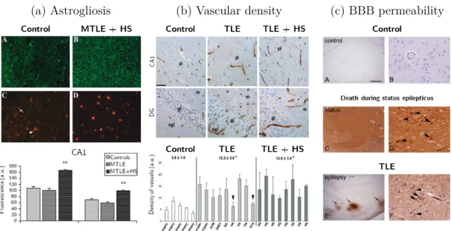 Figure 2.8 – Cellular and vascular changes in patients with temporal lobe epilepsy, adapted from (a) [65], (b) [62], and (c) [66].