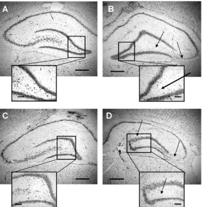 Figure 2.12 – Thionin-stained sections of rats kainate model, adapted from [83].