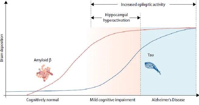 Figure  6 :  Modèle  hypothétique  de  la  corrélation  entre  l'accumulation  d'Aβ,  l’accumulation  de  tau,  les  perturbations d'activité neuronale et la maladie d'Alzheimer