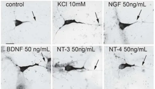 Figure 3. Les terminaisons 3’ UTR de l’ARNm de BDNF sont sensibles à l’activité. 