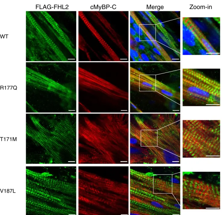 Fig. 5 Immunofluorescence analysis of rat-engineered heart tissue transduced with FHL2 wild type or variants