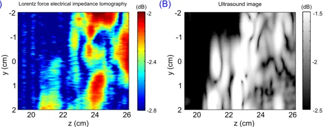 Figure 5. (A) Lorentz force electrical impedance tomography (LFEIT) image of the bovine muscle sample
