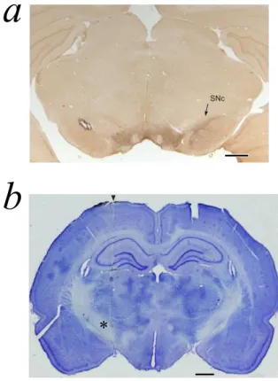 Figure 2: 6-OHDA lesion and reconstruction of the electrode track. Scale bars: