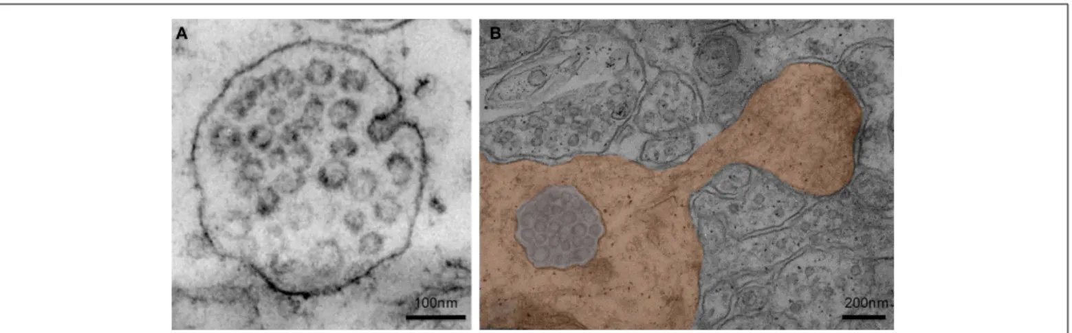 FIGURE 2 | (A) Electron micrograph of a multivesicular body present in a neuron of the CA1 region of the adult rat hippocampus