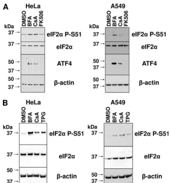 Figure 1. CsA increases levels of ATF4 protein and activity. A, protein extracts from HeLa and A549 cells treated with 1:500 DMSO, 5 m M BFA, 10 m M CsA, or 2 m M FK506 for 6 h were immunoblotted with the indicated antibodies