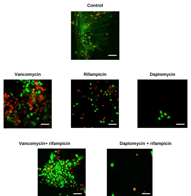 Figure S1: Visualization of Dacron ® -related MRSA BCB8 biofilm depending on treatment group by confocal  laser scanning microscope