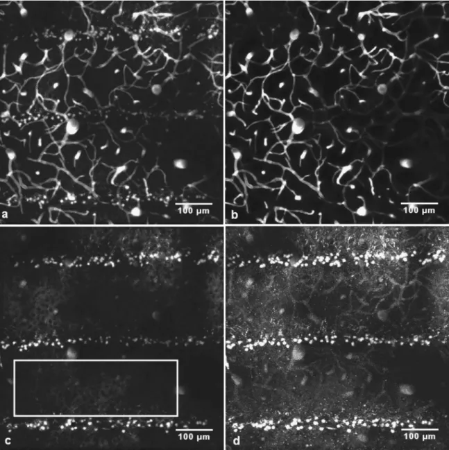 Fig. 2 共 a 兲 and 共 b 兲 z-projection 共 maximum intensity 兲 of stacks of images acquired in vivo from 150 to 300 ␮ m below the dura 共 in steps of 2 ␮ m 兲 in the left parietal cortex of a nude mouse 48 h after microbeam irradiation