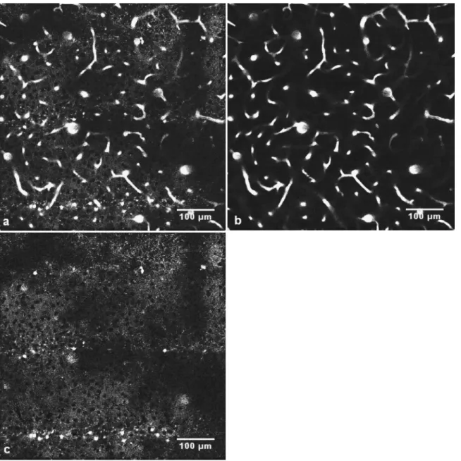 Fig. 4 Images obtained from the stacks of Fig. 2. 共 a 兲 A slice image at a depth of z= 150 ␮ m below the dura for the SRB channel