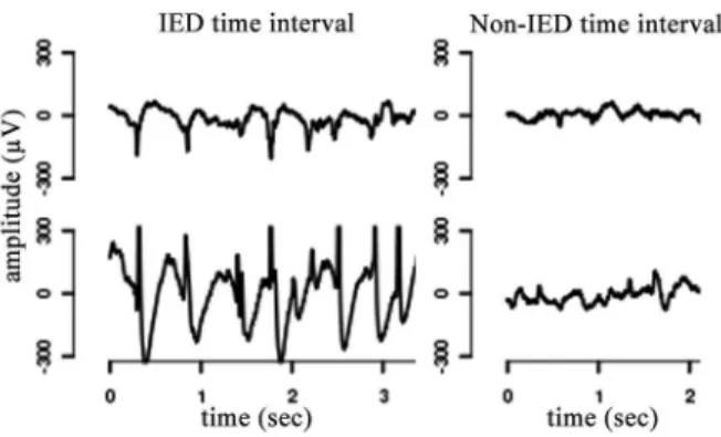 Figure 1. The main steps of the proposed method for the iEEG analysis.