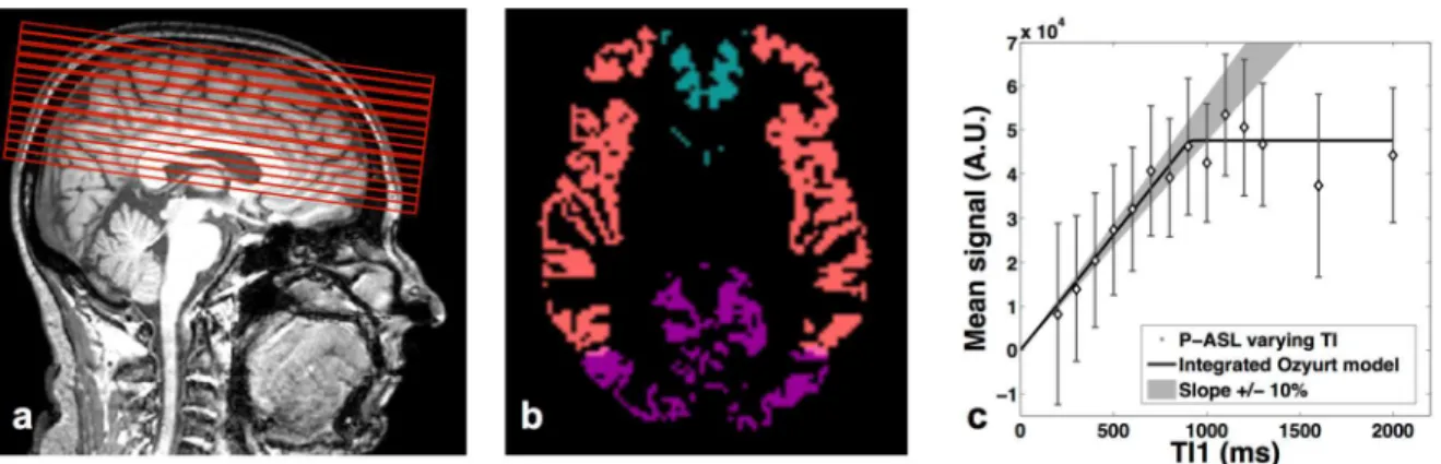 Figure 2: a) Position of the multi-TI 1  imaging slices. The first slice of the PASL  region  of  interest  is  the  same  as  the  BoTuS  slice,  b)  Vascular  territory  map  (pink: middle cerebral arteries, blue: anterior cerebral arteries, purple: post