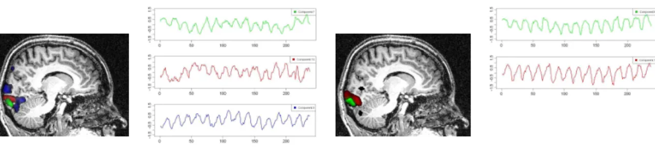 Figure 8: Time course of extracted components and their spatial localization. Left: extracted components using tICA