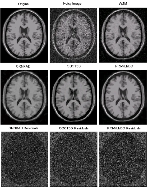 Fig. 5. Example filtering results  for an axial slice  of the T1w BrainWeb phantom (Rician  noise  level  of  15%)