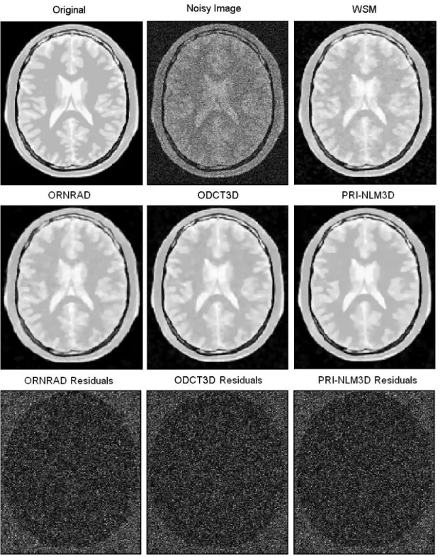 Fig. 6. Example filtering results for an axial slice of the PDw BrainWeb phantom (Rician noise  level  of  15%)