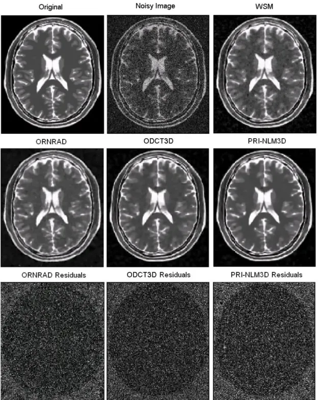 Fig. 7. Example filtering results for an axial slice  of the T2w BrainWeb phantom (Rician  noise  level  of  15%)
