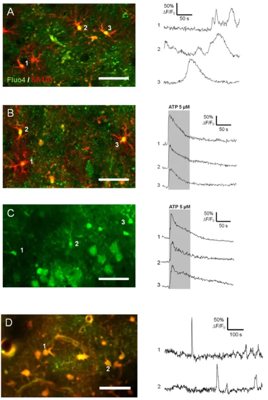 Figure 6. Calcium signaling in neocortical astrocytes stained with SR101. A) Left panel: merged confocal images of astrocytes labeled with SR101 (iv injection; red) and incubated with 5 mM Fluo-4 AM (green) in acute brain slice (P17 rat)