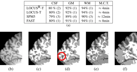 Figure 4 shows the results obtained with LOCUS B -T, and LOCUS B -TSR on a real 3T brain scan