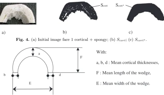 Fig. 4. (a) Initial image face 1 cortical + spongy; (b) S cort ; (c) S cort ∗ .