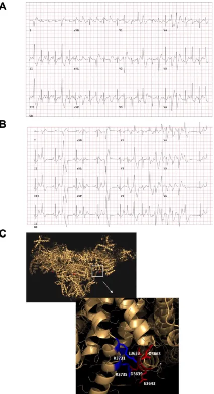 Figure  1.  Clinical  characterization  of  the  catecholaminergic  polymorphic  ventricular  tachycardia  (CPVT) patient and in silico modeling