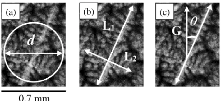 Fig. 2: Dendritic grain characteristics measured in the present paper: (a) Diameter d of the  equivalent disk, (b) L 1  length of the longest straight segment in the grain and L 2  length of the  longest straight segment in the grain and orthogonal to the 