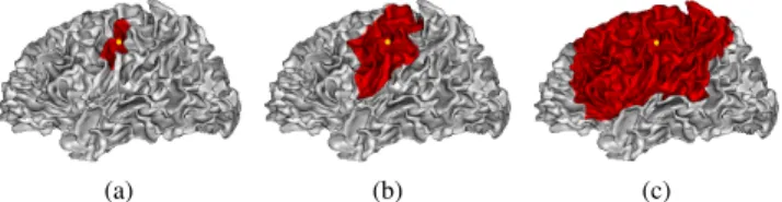 Fig. 1. The spread of the adaptive window function (10) with 3 different window sizes around the yellow vertex on a cortical surface by thresholding the values of the window functions at the same percentage of their maximal values
