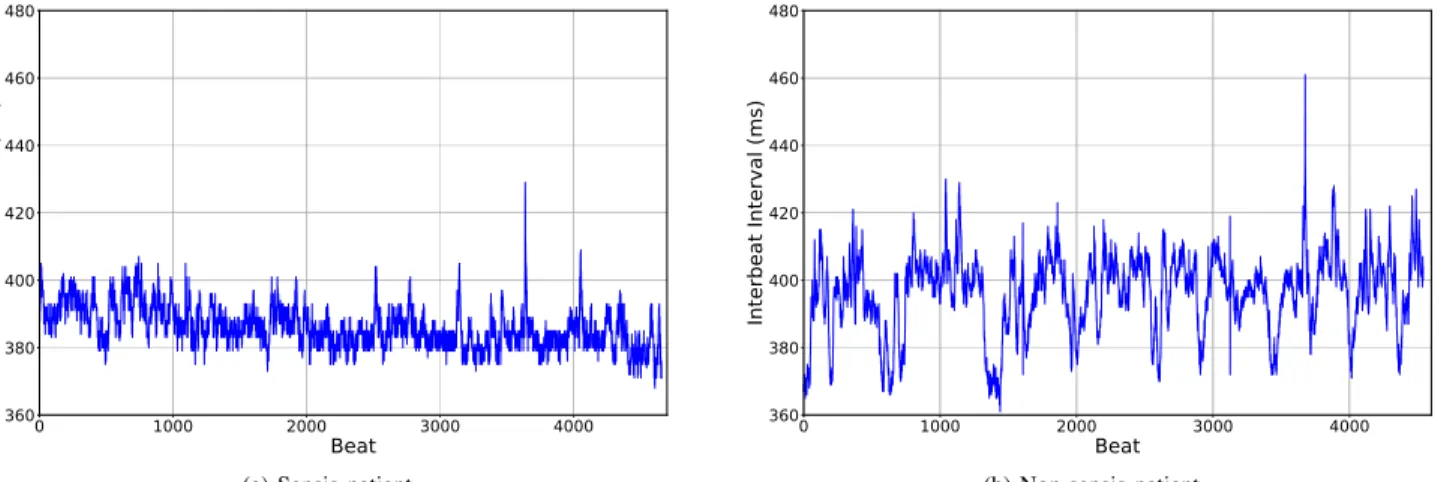 Fig. 6: RR time series for 30-minute segments observed three hours before t 0 .