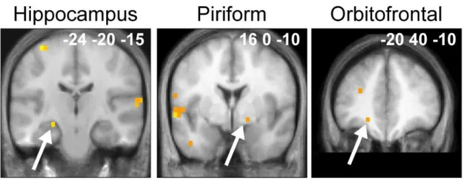 Figure 4. Whole-brain multiple regression analyis. Significant negative correlations between the activation levels and the length of expertise were detected in the left hippocampus, the right PC and the left orbitofrontal cortex in professionals during the